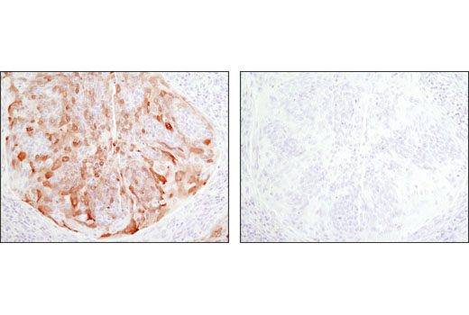Immunohistochemistry Image 4: Phospho-NDRG1 (Thr346) (D98G11) Rabbit Monoclonal Antibody (BSA and Azide Free)