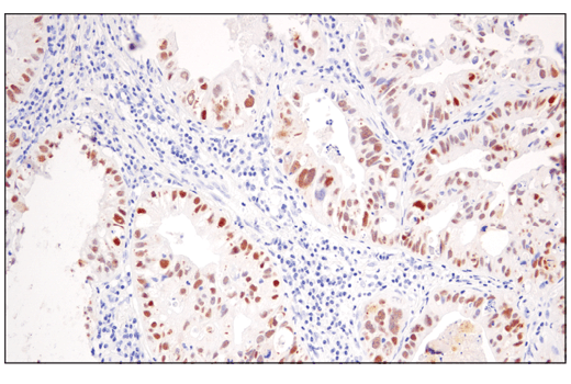 Immunohistochemistry Image 1: PRAME (E7I1B) Rabbit Monoclonal Antibody