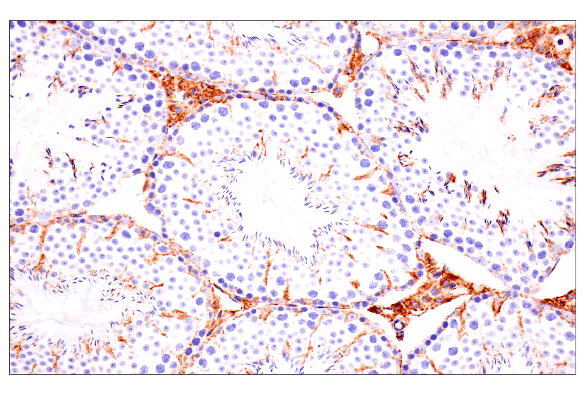 Immunohistochemistry Image 5: TSPO (F5B8F) Rabbit Monoclonal Antibody