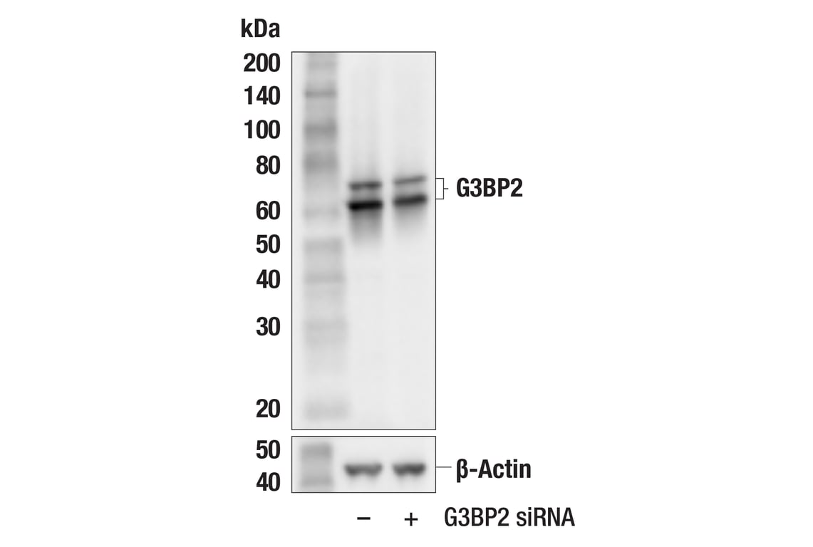 Western Blotting Image 2: G3BP2 (F3Y7Z) Mouse Monoclonal Antibody