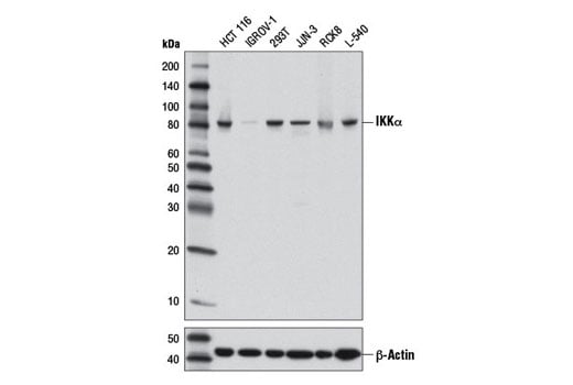 undefined Image 1: NF-κB Pathway Antibody Sampler Kit