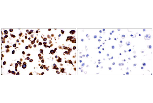 Immunohistochemistry Image 11: COL1A1 (E8F4L) Rabbit Monoclonal Antibody (BSA and Azide Free)