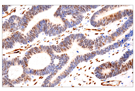 Immunohistochemistry Image 1: TAZ (E9J5A) Rabbit Monoclonal Antibody (BSA and Azide Free)