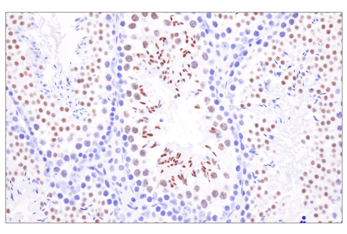 Immunohistochemistry Image 11: Acetyl-Histone H4 (Lys16) (E2B8W) Rabbit Monoclonal Antibody