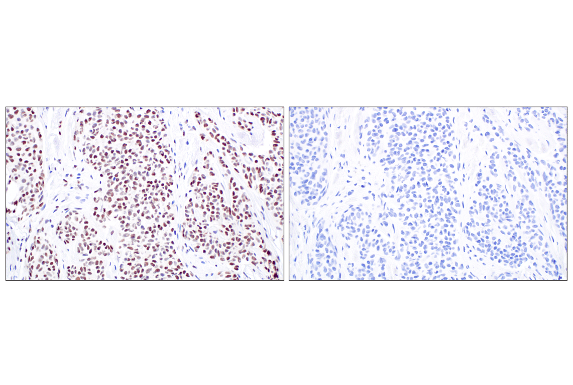 Immunohistochemistry Image 3: WT1 (F3T7B) Rabbit Monoclonal Antibody (Carboxy-terminal Antigen)