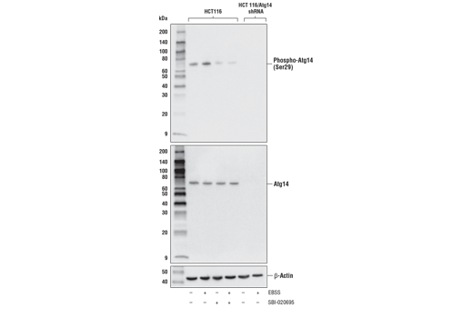 Western Blotting Image 2: Phospho-Atg14 (Ser29) (D4B8M) Rabbit Monoclonal Antibody