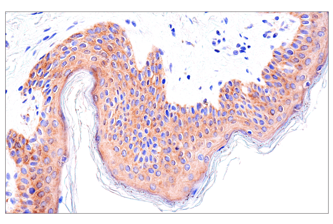 Immunohistochemistry Image 11: SLC25A1 (E7B2B) Rabbit Monoclonal Antibody