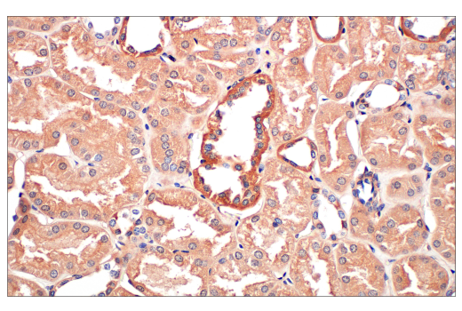 Immunohistochemistry Image 4: Ras (E8N8L) Rabbit Monoclonal Antibody (BSA and Azide Free)