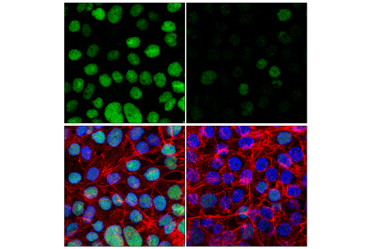 Immunofluorescence Image 1: NSUN2 (E6N6I) Rabbit Monoclonal Antibody