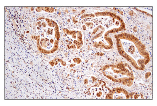 undefined Image 1: MGMT (E9O4V) Rabbit Monoclonal Antibody