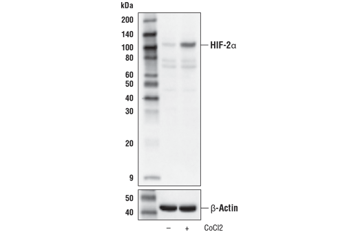 Western Blotting Image 2: HIF-2 alpha (D6T8V) Rabbit Monoclonal Antibody
