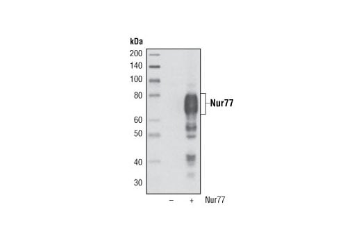 Western Blotting Image 1: Nur77 (D63C5) XP<sup>®</sup> Rabbit mAb