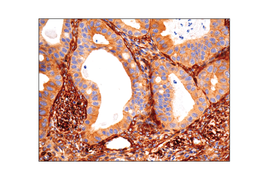 Immunohistochemistry Image 1: Vinculin (E1E9V) XP<sup>®</sup> Rabbit mAb (BSA and Azide Free)