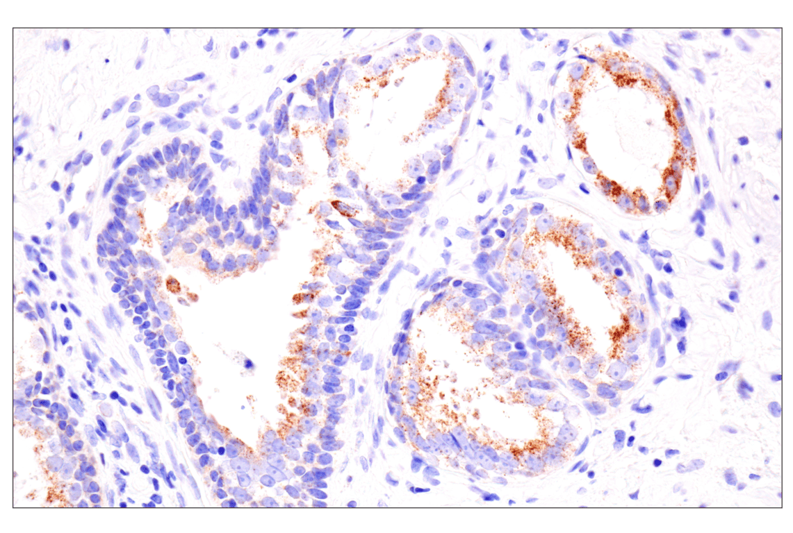 Immunohistochemistry Image 7: AMACR (F7T6V) Rabbit Monoclonal Antibody
