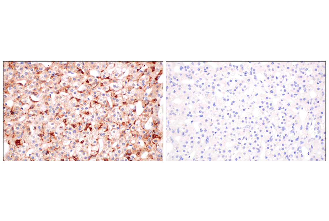 Immunohistochemistry Image 11: SHMT1 (F5Q3S) Rabbit Monoclonal Antibody