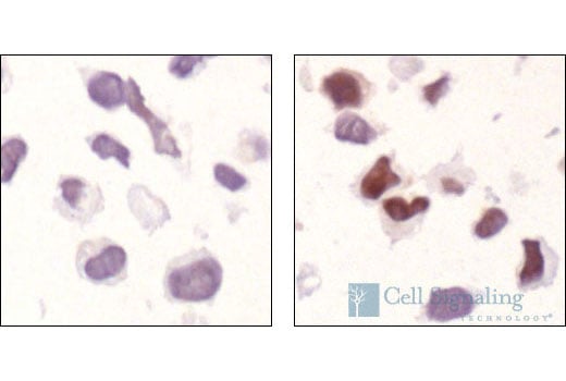Immunohistochemistry Image 3: Phospho-ATF-2 (Thr69/71) Antibody