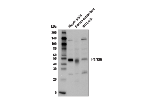 Western Blotting Image 2: Parkin Antibody