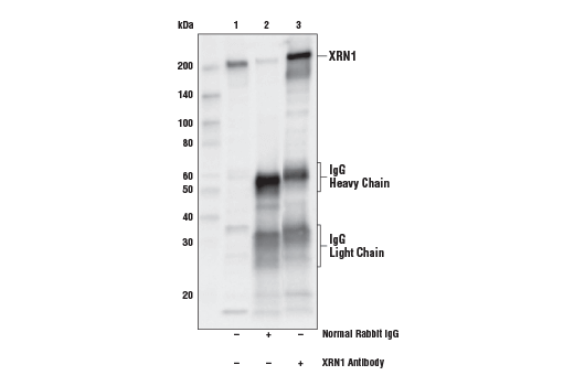 Immunoprecipitation Image 1: XRN1 Antibody