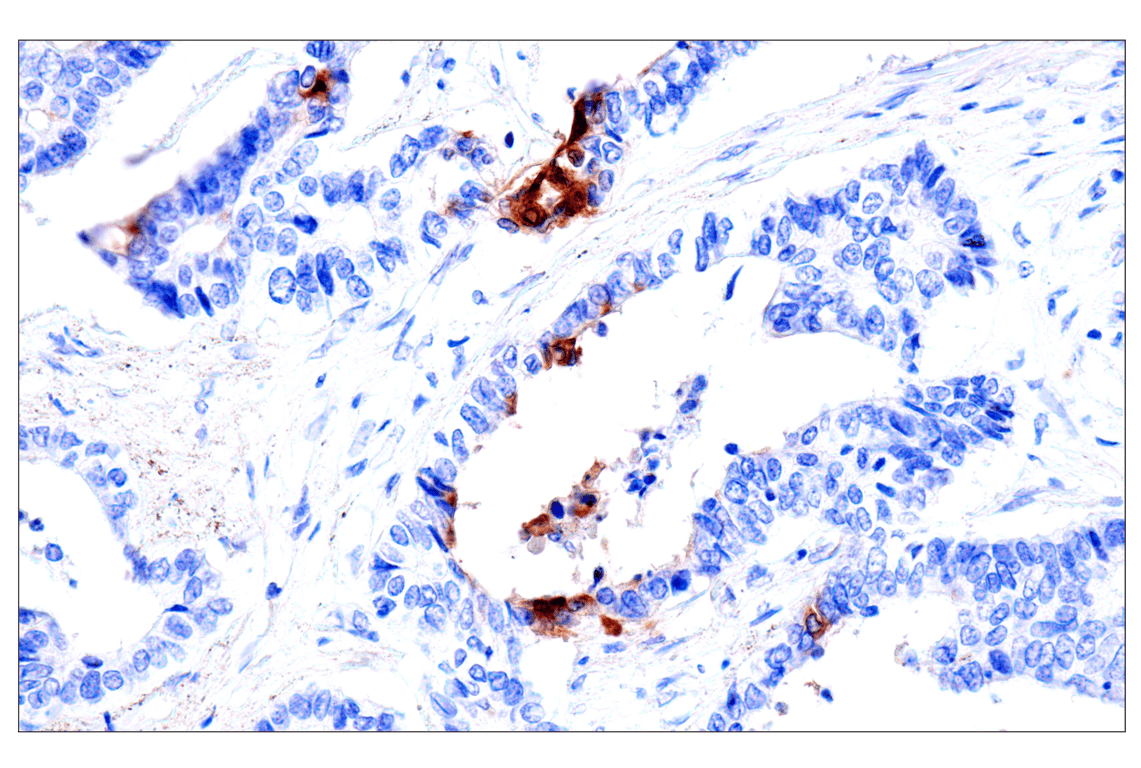 Immunohistochemistry Image 6: CEACAM7 (E5Q6X) Rabbit Monoclonal Antibody (BSA and Azide Free)