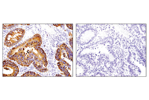 Immunohistochemistry Image 4: OLFM4 (D1E4M) Rabbit Monoclonal Antibody (BSA and Azide Free)
