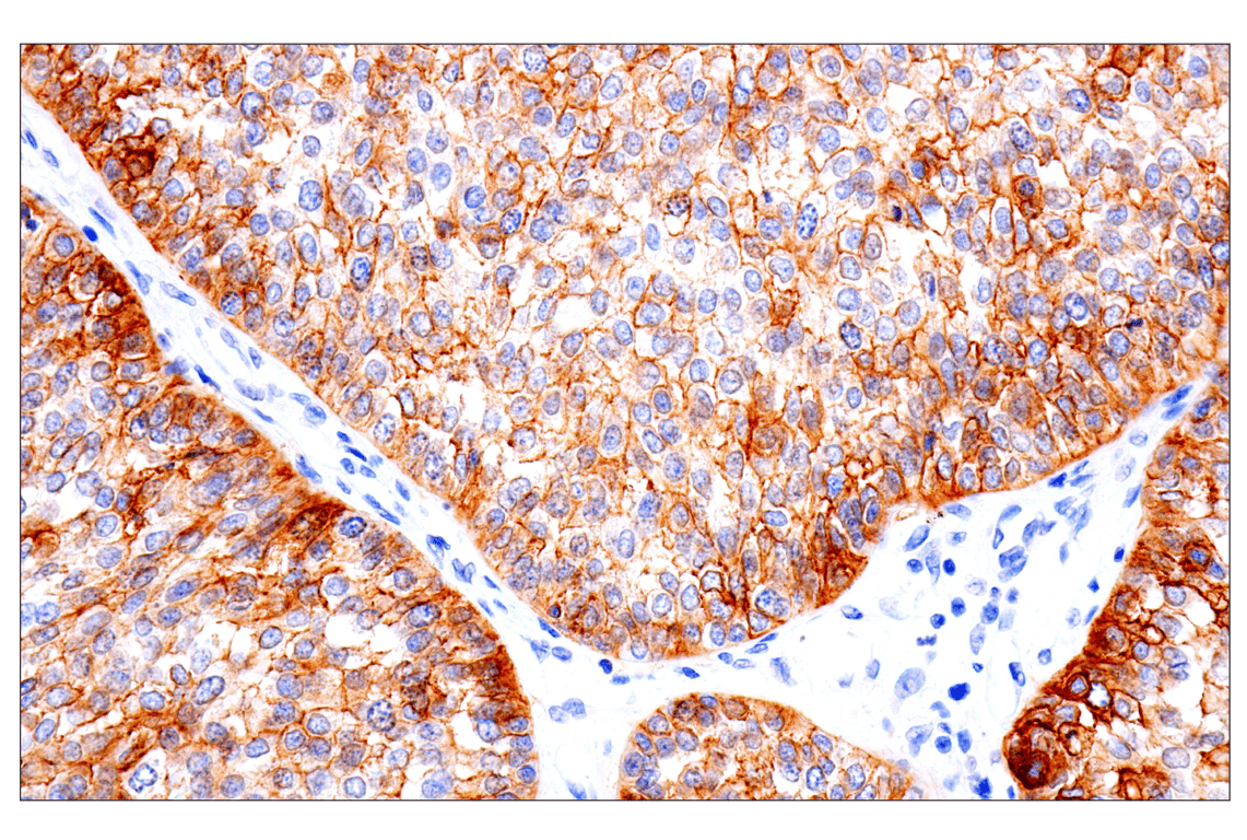Immunohistochemistry Image 4: Integrin beta6 (E4M9P) Rabbit Monoclonal Antibody