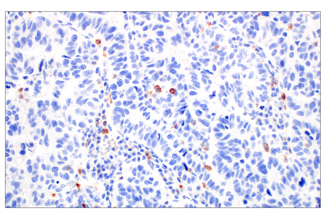 Immunohistochemistry Image 1: CD70 (E3Q1A) Rabbit Monoclonal Antibody