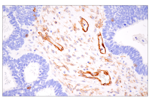 Immunohistochemistry Image 1: Integrin alpha1/CD49a (E9K2J) Rabbit Monoclonal Antibody (BSA and Azide Free)