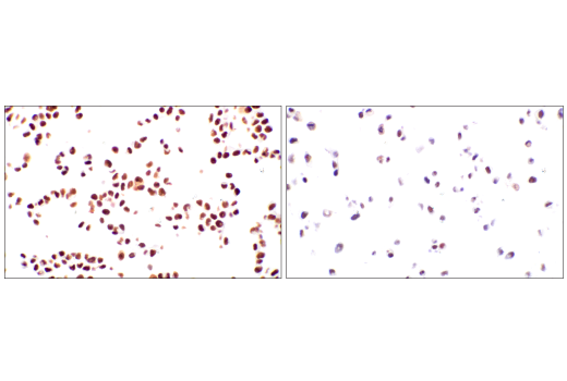 XRCC1 (E4A3V) XP® Rabbit mAb | Cell Signaling Technology