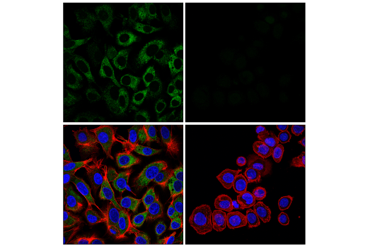 Immunofluorescence Image 1: alpha-2-Macroglobulin (E4H4U) Rabbit Monoclonal Antibody