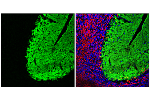 Immunofluorescence Image 1: EAAT4 (E6E9I) Rabbit Monoclonal Antibody