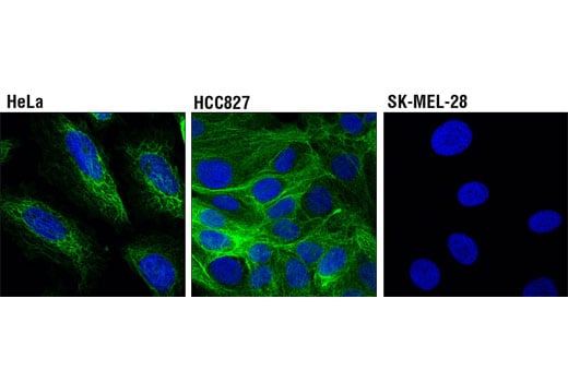 Immunofluorescence Image 1: Keratin 17/19 (D4G2) Rabbit Monoclonal Antibody (BSA and Azide Free)