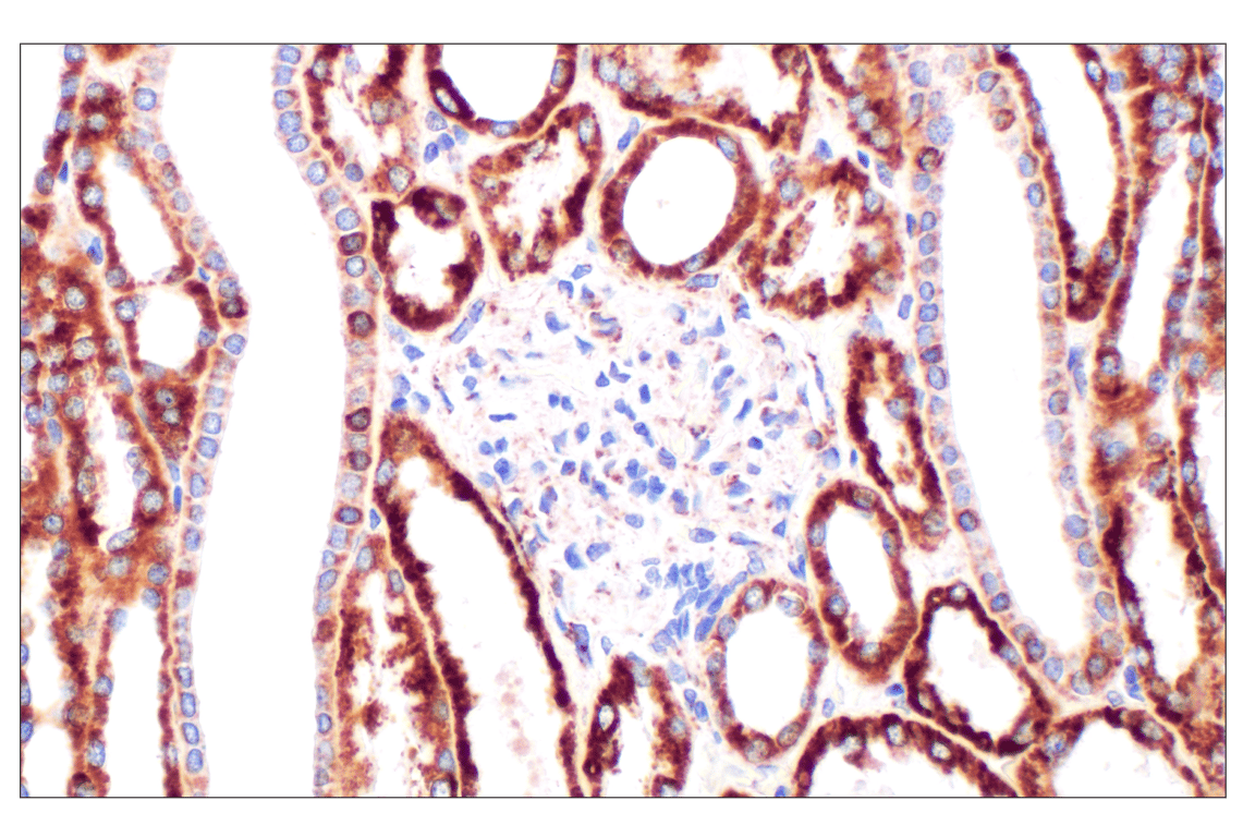 undefined Image 39: Organelle Localization IF Antibody Sampler Kit