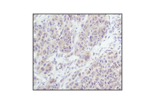 Immunohistochemistry Image 3: Akt (pan) (11E7) Rabbit Monoclonal Antibody (BSA and Azide Free)