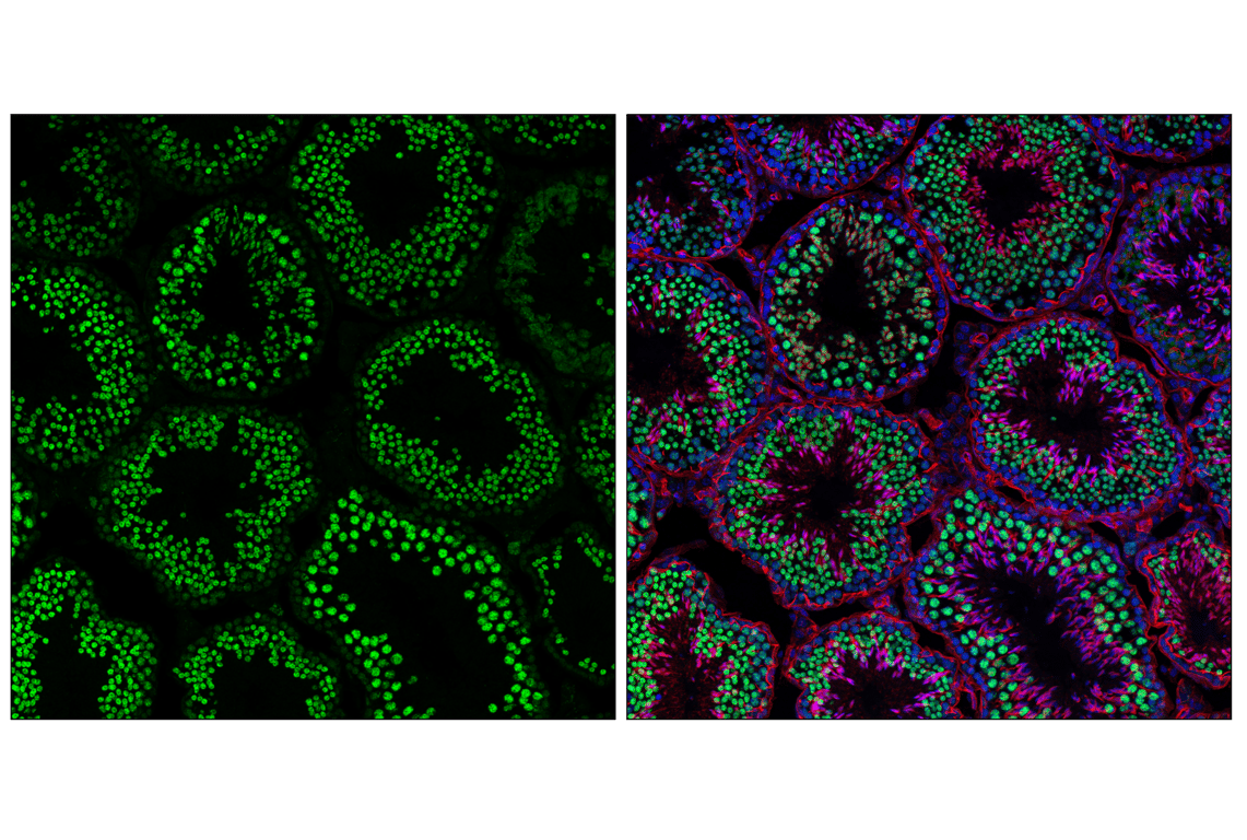 Immunofluorescence Image 1: Matrin 3 (F4Q5F) Rabbit Monoclonal Antibody