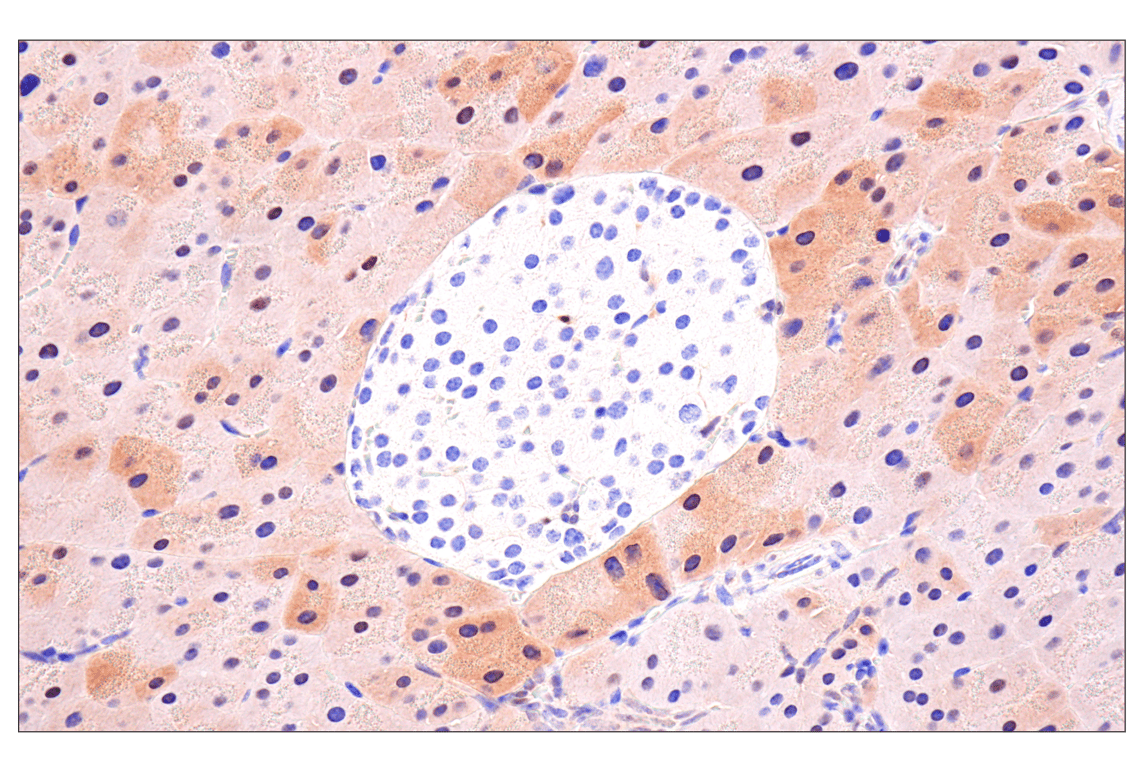 Immunohistochemistry Image 10: CDK6 (E3E3Q) Rabbit Monoclonal Antibody