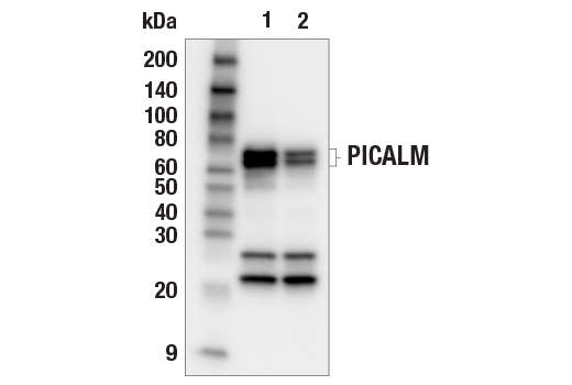 Western Blotting Image 2: PICALM (E3J9R) Rabbit Monoclonal Antibody