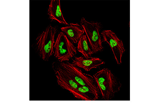 Immunofluorescence Image 1: YY1 (D3D4Q) Rabbit Monoclonal Antibody