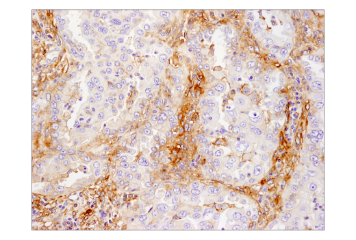 Immunohistochemistry Image 2: B7-H3 (D9M2L) Rabbit Monoclonal Antibody (BSA and Azide Free)