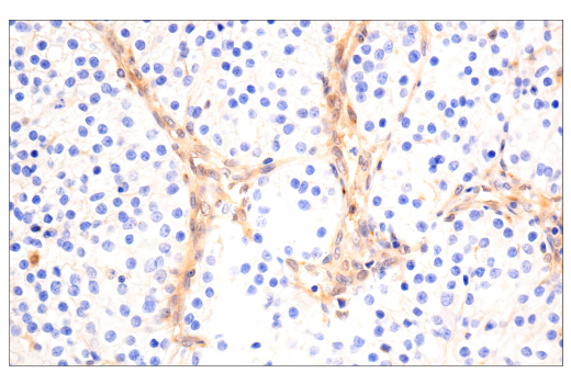 Immunohistochemistry Image 1: VHL (E3X9K) Rabbit Monoclonal Antibody