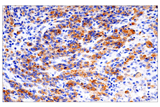 undefined Image 30: SARS-CoV-2 Virus-Host Interaction Antibody Sampler Kit