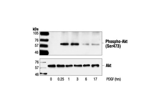 Western Blotting Image 3: Akt Antibody