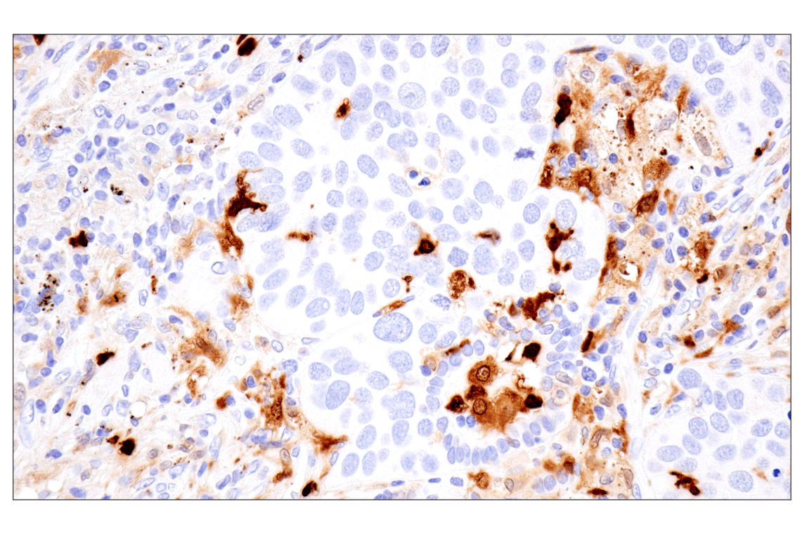 Immunohistochemistry Image 5: S100A8 (F4R2W) Rabbit Monoclonal Antibody