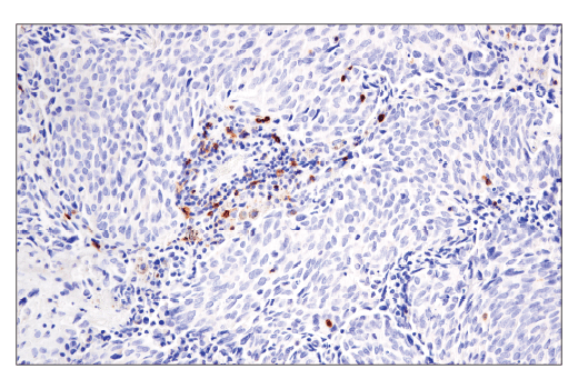 Immunohistochemistry Image 5: GITR (D5V7P) Rabbit Monoclonal Antibody (BSA and Azide Free)