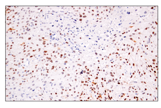 Immunohistochemistry Image 1: p14 ARF (E3X6D) Rabbit mAb (BSA and Azide Free)