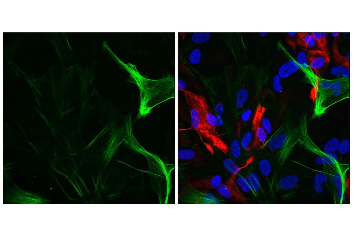 Immunofluorescence Image 2: Calponin 1 (D8L2T) Rabbit Monoclonal Antibody
