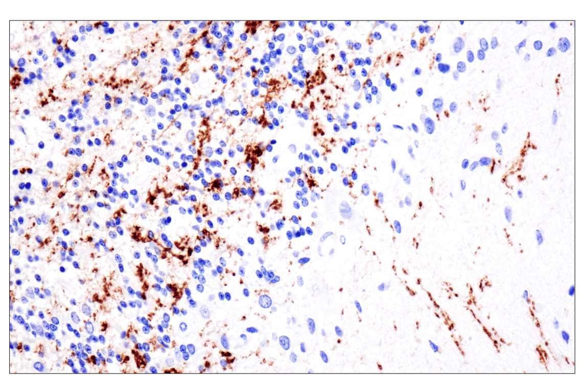 Immunohistochemistry Image 2: VGLUT2 (F1T6V) Rabbit Monoclonal Antibody