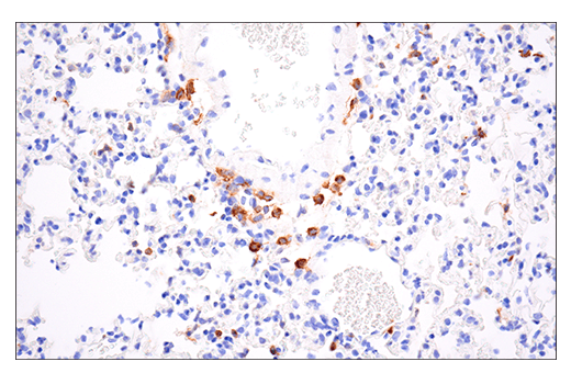 Immunohistochemistry Image 2: CD86 (E5W6H) Rabbit mAb