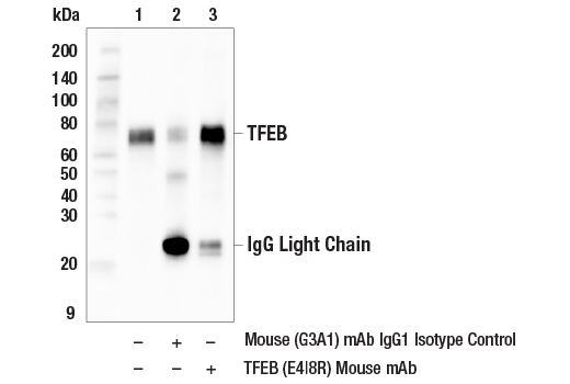 Immunoprecipitation Image 1: TFEB (E4I8R) Mouse Monoclonal Antibody