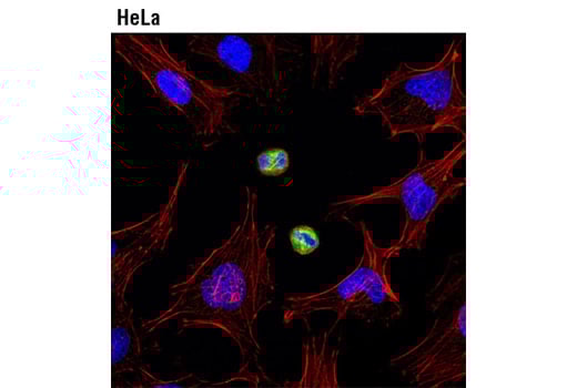 Immunofluorescence Image 1: Phospho-Vimentin (Ser83) (D5A2D) Rabbit Monoclonal Antibody