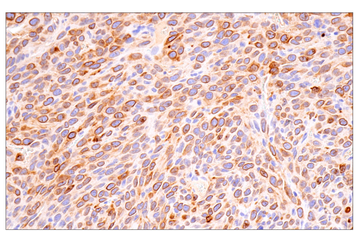 Immunohistochemistry Image 8: Cox2 (D5H5) Rabbit Monoclonal Antibody (BSA and Azide Free)